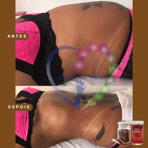 Resultado antes e depois 1