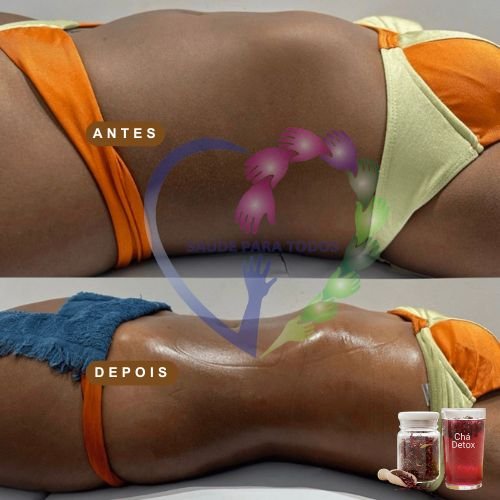 Resultado antes e depois 2