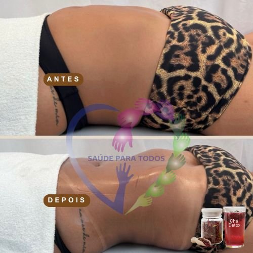 Resultado antes e depois 3