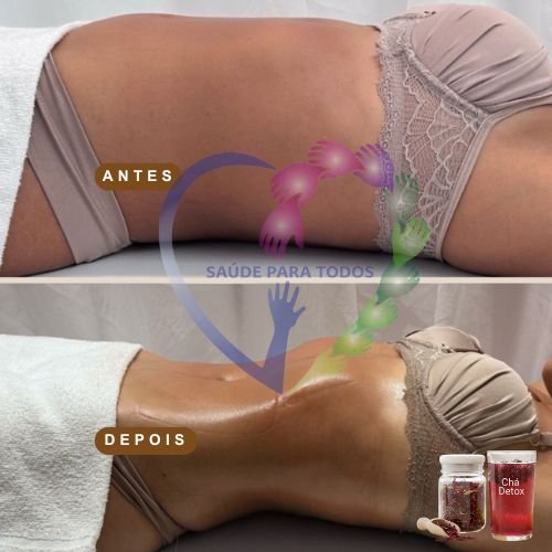 Resultado antes e depois 4