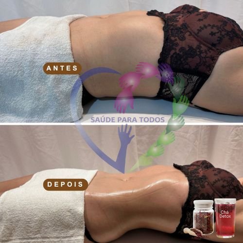 Resultado antes e depois 5