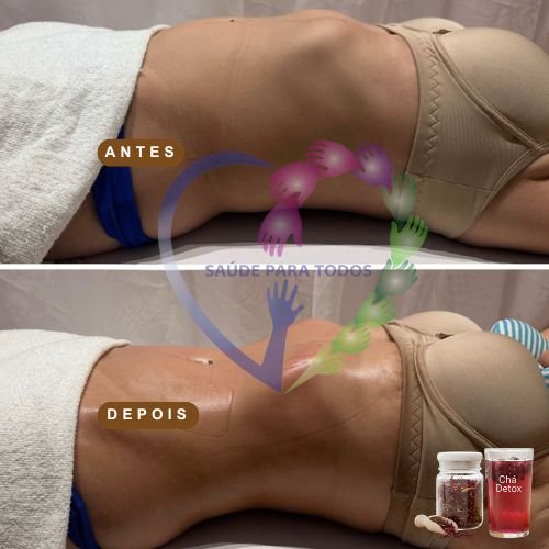 Resultado antes e depois 7