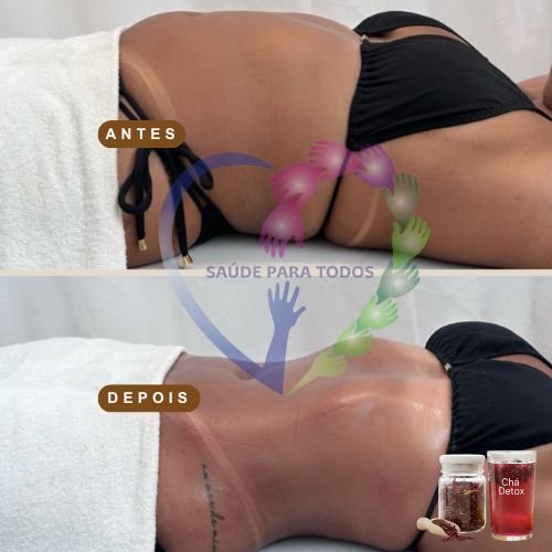 Resultado antes e depois 8